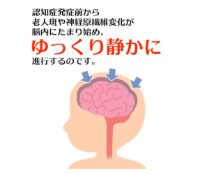 認知症発症前からゆっくり静かに進行する
